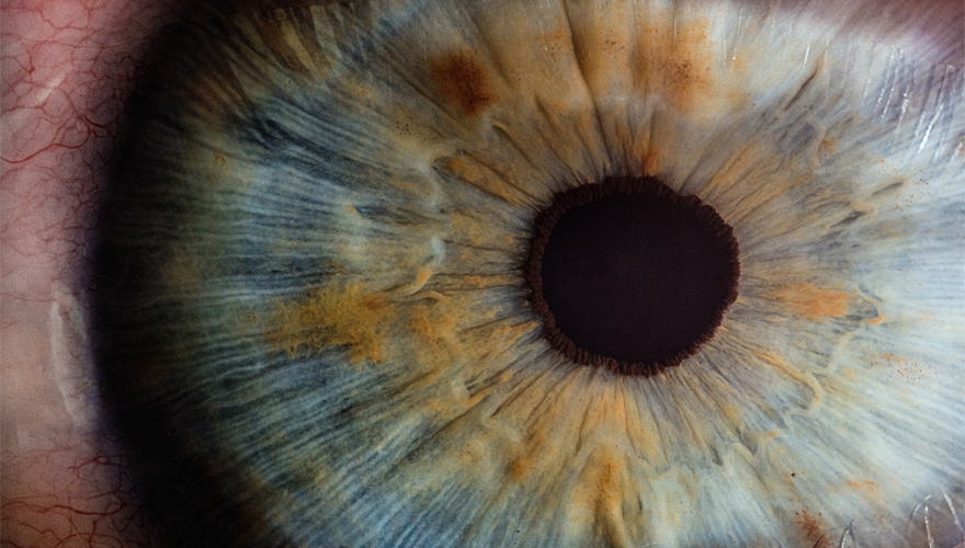 Human eye