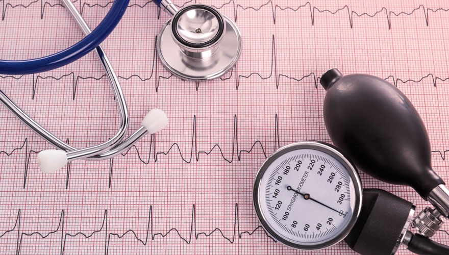 Image of a stethoscope on a pulse sheet